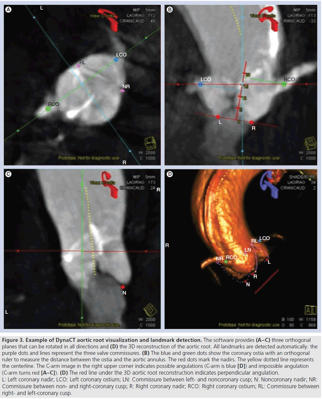 interventional-cardiology-orthogonal