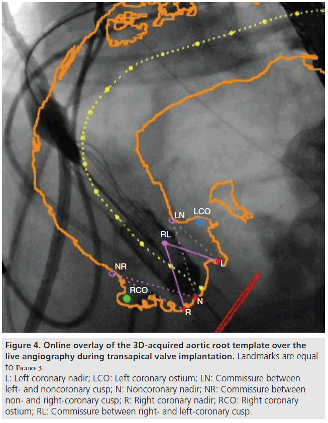 interventional-cardiology-orthogonal