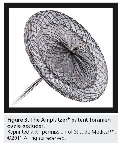 interventional-cardiology-patent-foramen