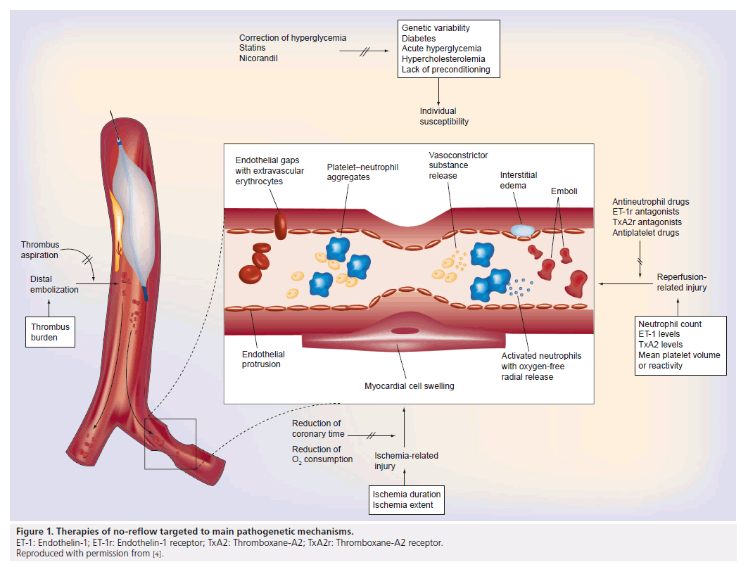 interventional-cardiology-pathogenetic-mechanisms