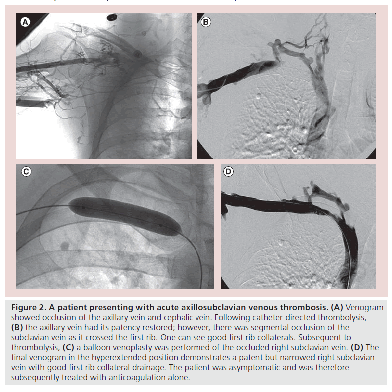 interventional-cardiology-patient-presenting