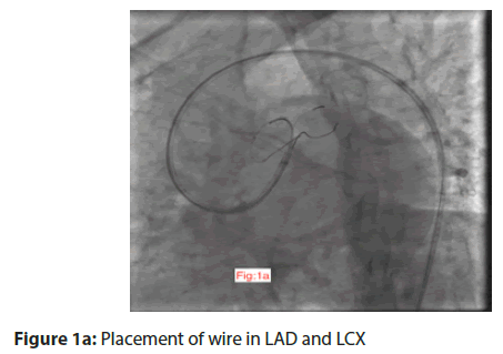 interventional-cardiology-placement