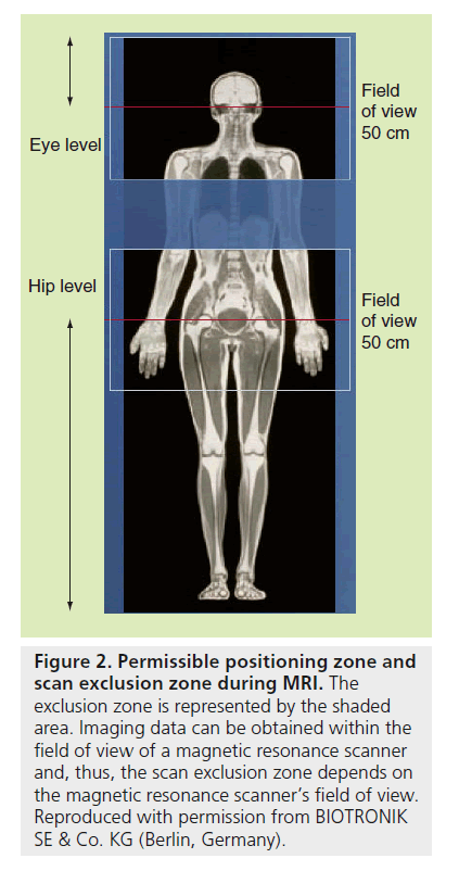 interventional-cardiology-positioning-zone