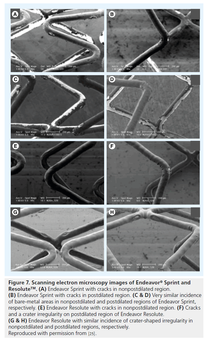 interventional-cardiology-postdilated-regions