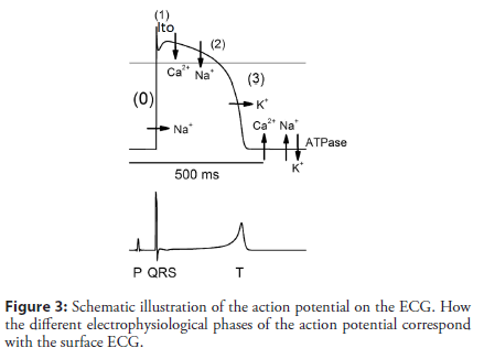 interventional-cardiology-potential