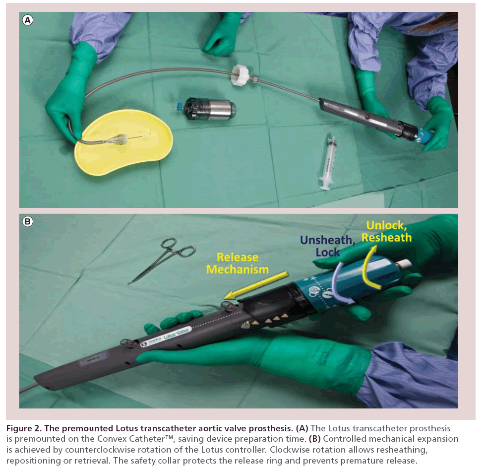 interventional-cardiology-premounted-Lotus