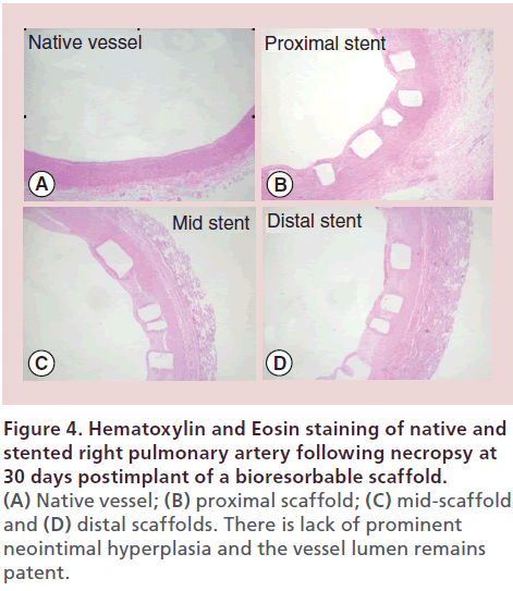 interventional-cardiology-pulmonary