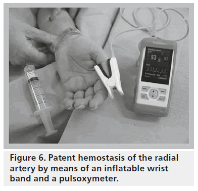 interventional-cardiology-radial