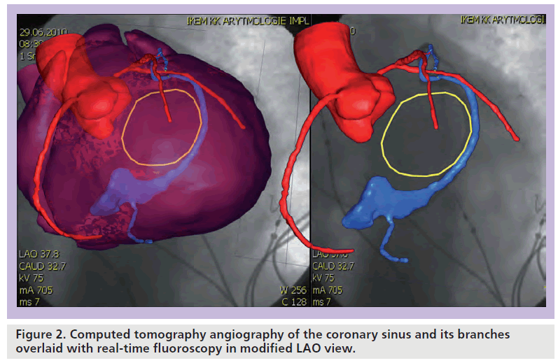 interventional-cardiology-real-time-fluoroscopy