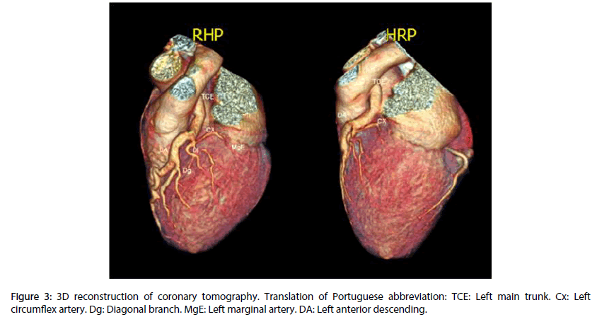 interventional-cardiology-reconstruction-coronary