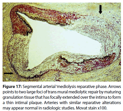 interventional-cardiology-reparative-alterations