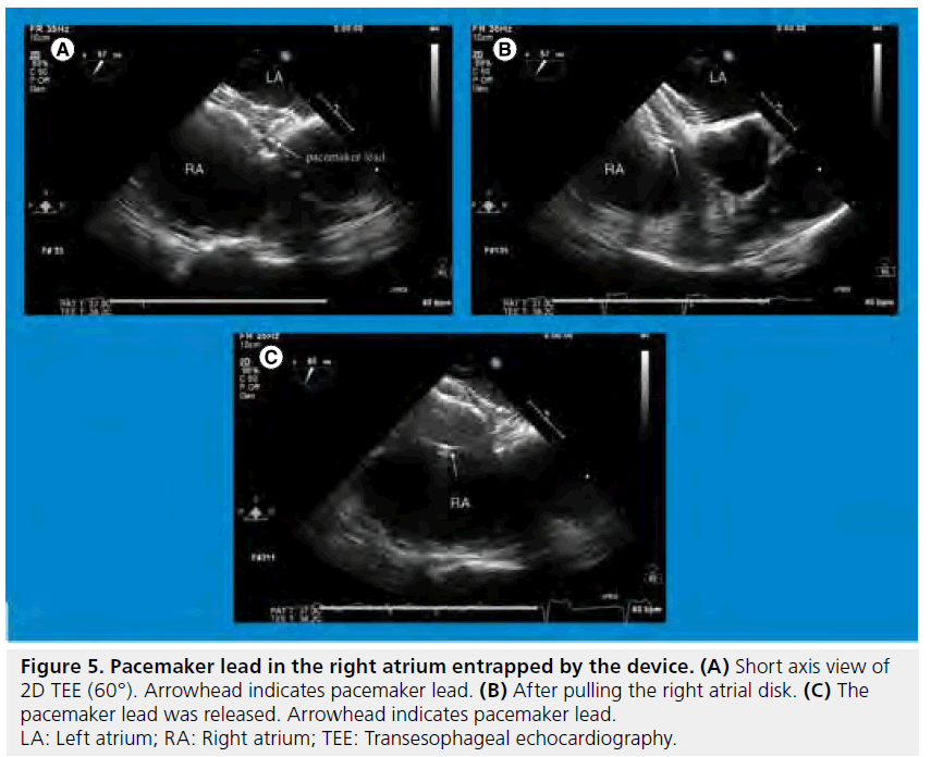 interventional-cardiology-right