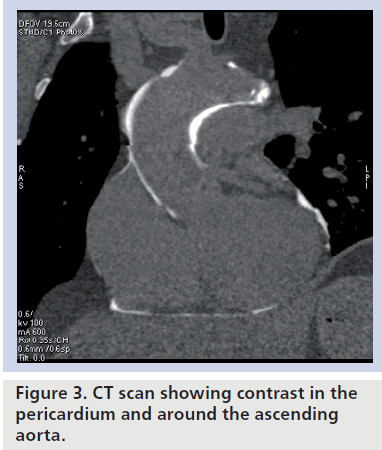 interventional-cardiology-scan