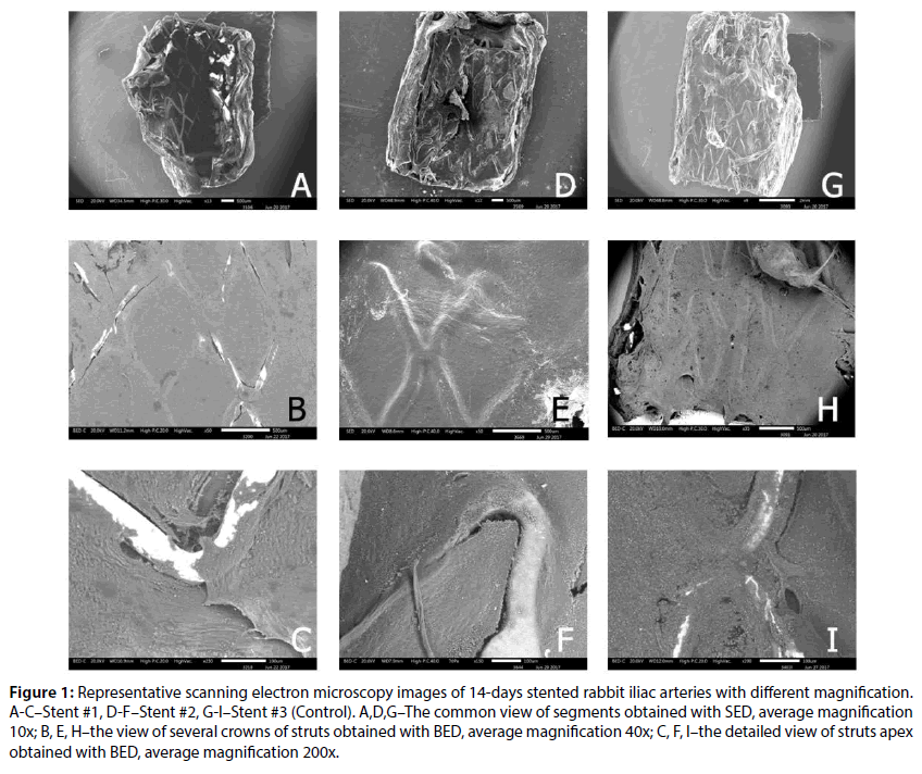 interventional-cardiology-scanning-electron