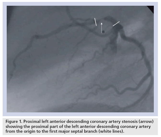 interventional-cardiology-septal-branch