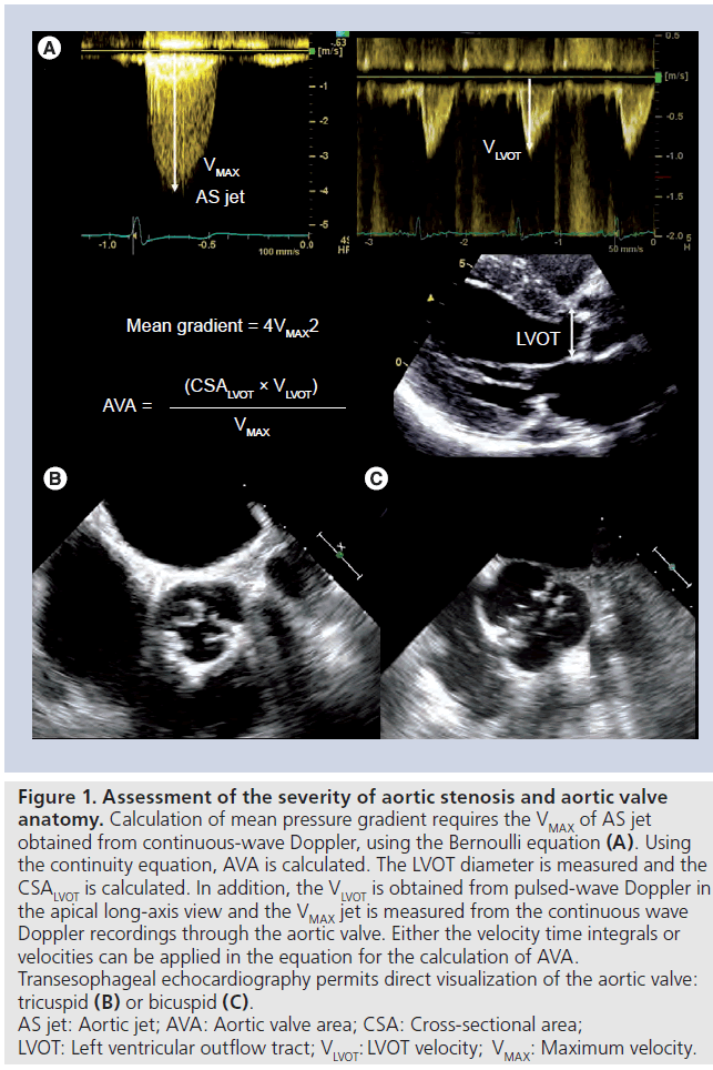 interventional-cardiology-severity