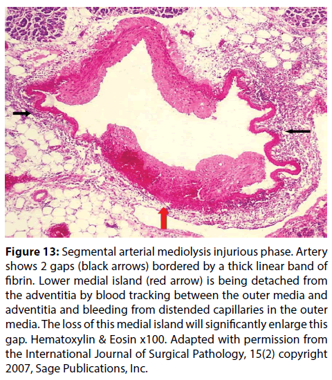 interventional-cardiology-significantly-enlarge