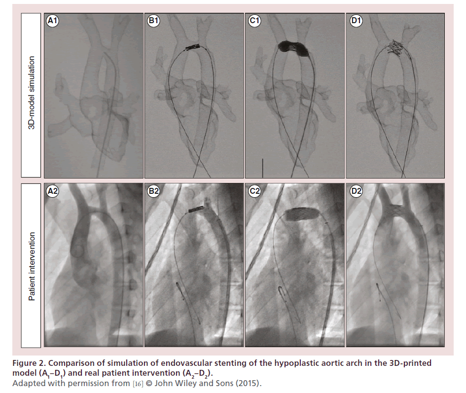 interventional-cardiology-simulation-endovascular