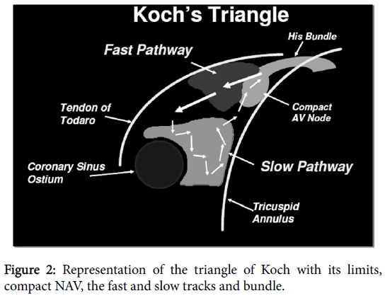 interventional-cardiology-slow-tracks