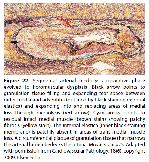 interventional-cardiology-staining-external
