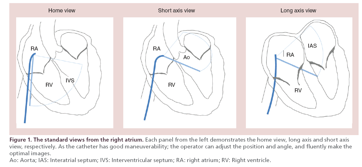 interventional-cardiology-standard-views
