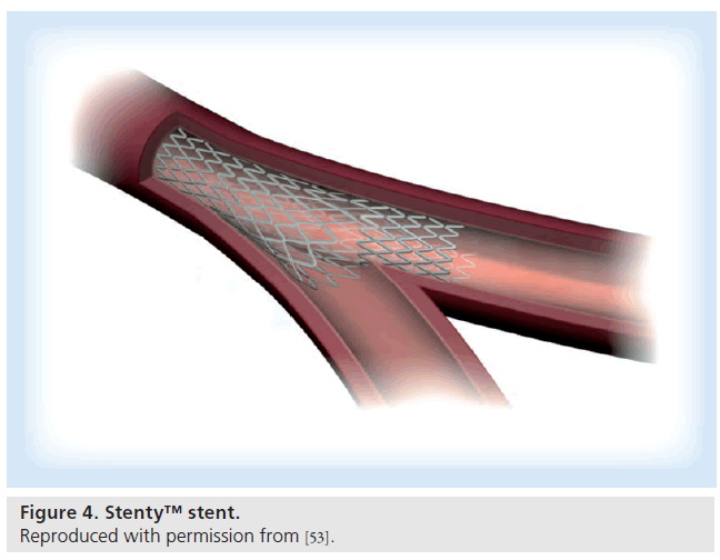 interventional-cardiology-stent-permission