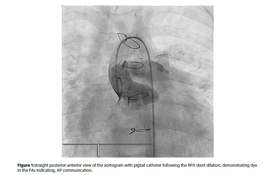 interventional-cardiology-straight-posterior