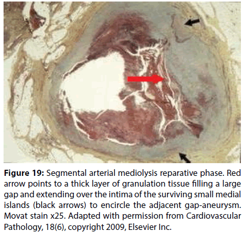 interventional-cardiology-surviving-small