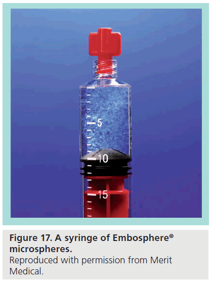 interventional-cardiology-syringe-Embosphere