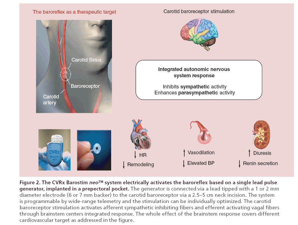 interventional-cardiology-system-electrically