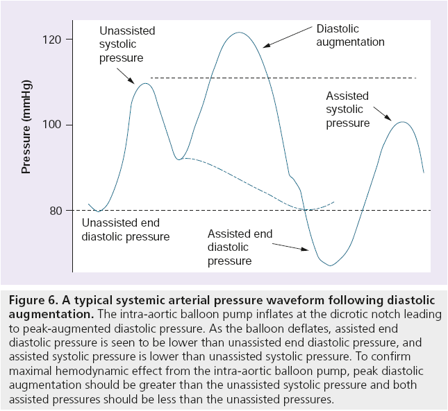 interventional-cardiology-systemic-arterial-pressure