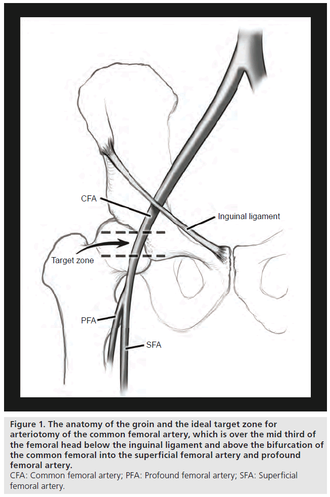 interventional-cardiology-target-zone