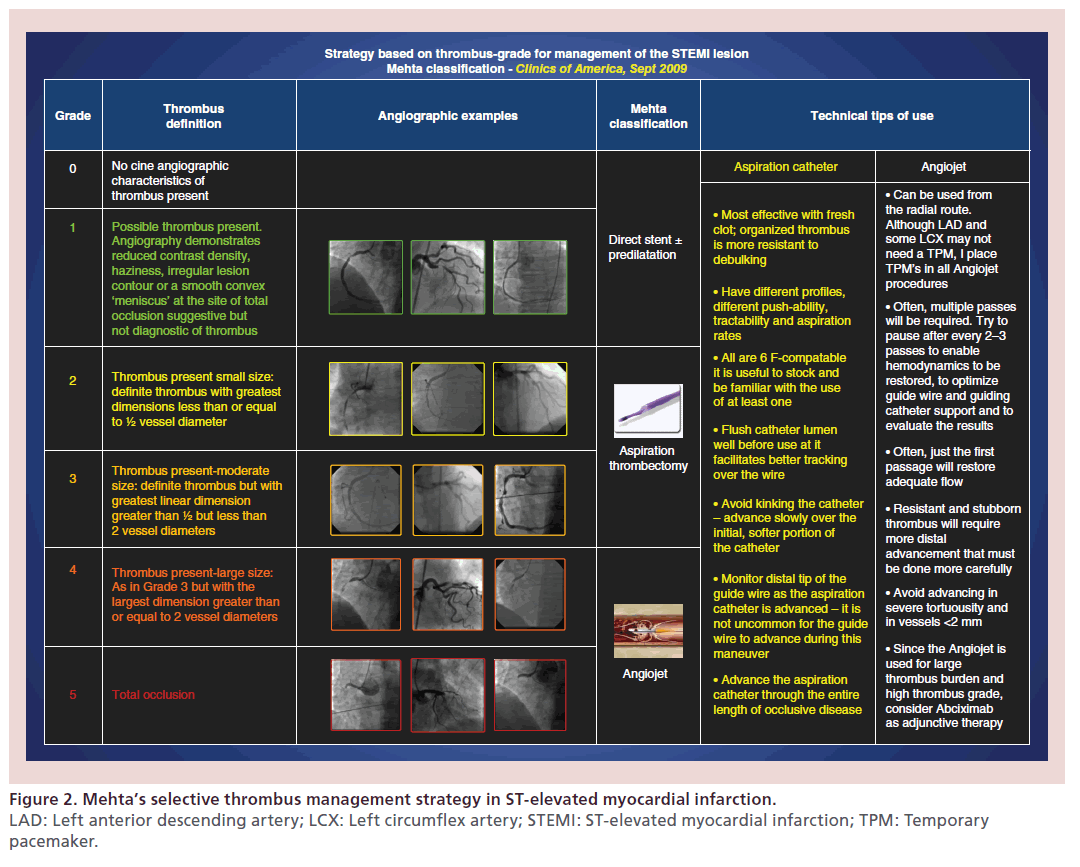 interventional-cardiology-thrombus-management