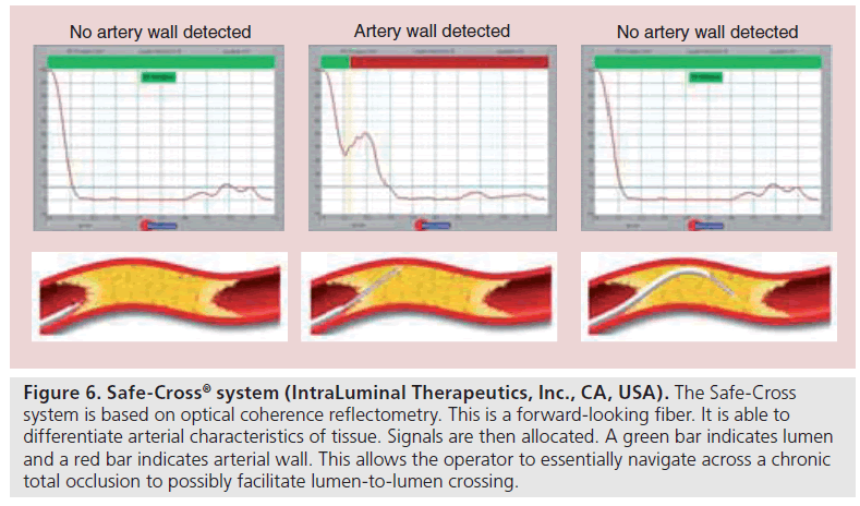 interventional-cardiology-tissue-Signals
