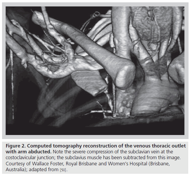 interventional-cardiology-tomography-reconstruction