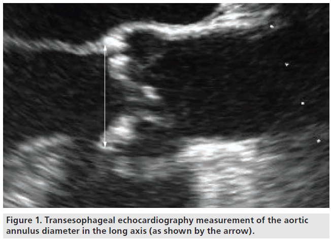 interventional-cardiology-transcatheter