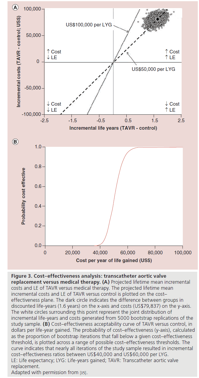 interventional-cardiology-transcatheter-aortic