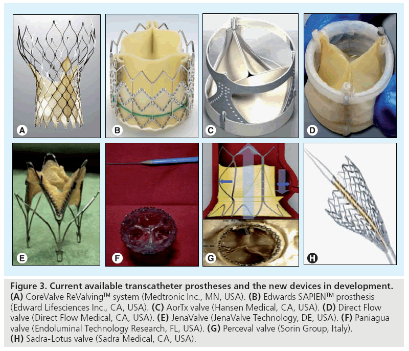 interventional-cardiology-transcatheter-prostheses