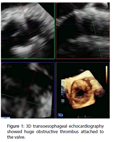 interventional-cardiology-transoesophageal-echocardiography