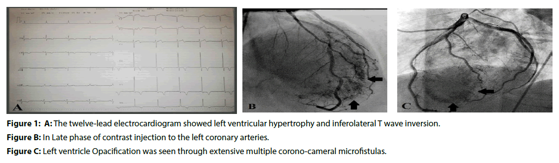 interventional-cardiology-twelve-lead-electrocardiogram