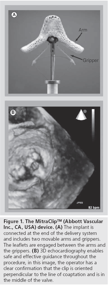 interventional-cardiology-two-movable-arms