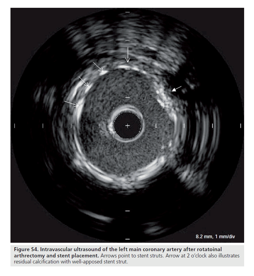 interventional-cardiology-ultrasound