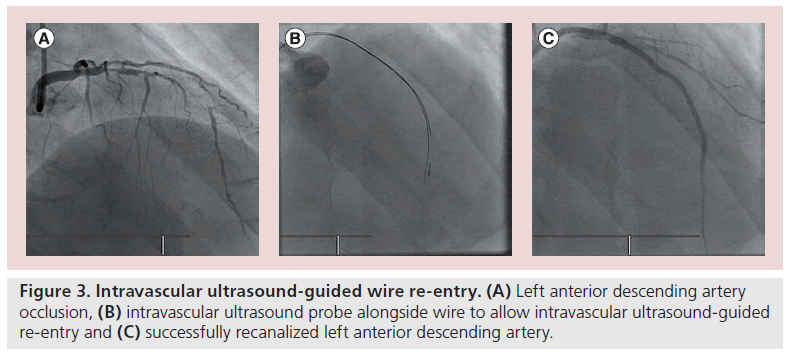 interventional-cardiology-ultrasound-entry
