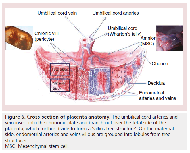 interventional-cardiology-umbilical-cord-arteries