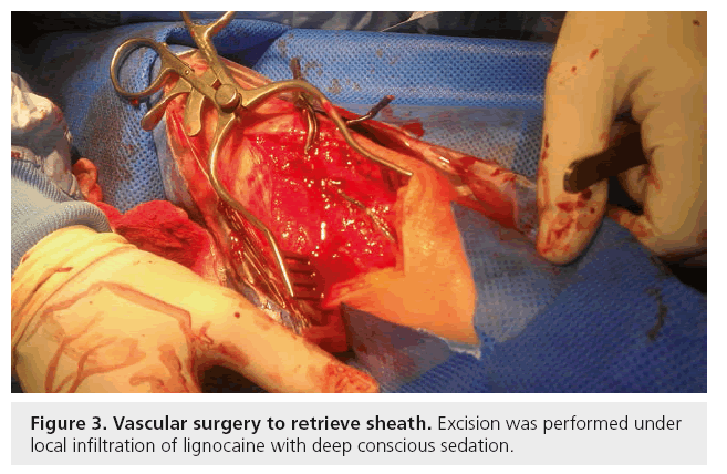 interventional-cardiology-vascular-surgery