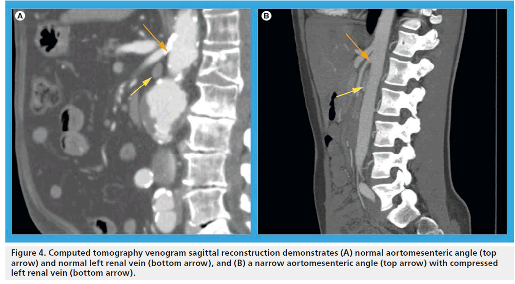 interventional-cardiology-venogram