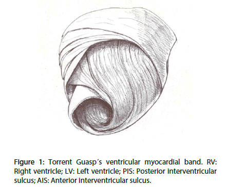 interventional-cardiology-ventricular-myocardial