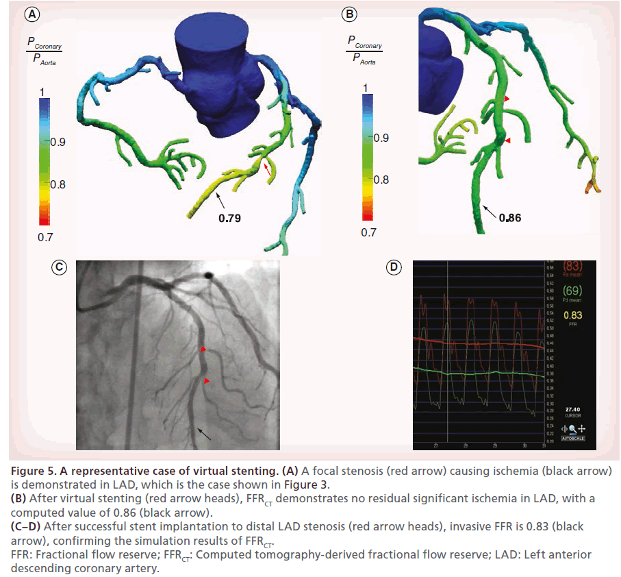 interventional-cardiology-virtual