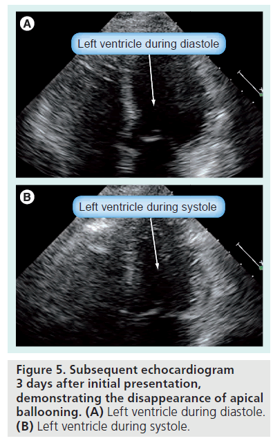 interventional-cardiology-waveform