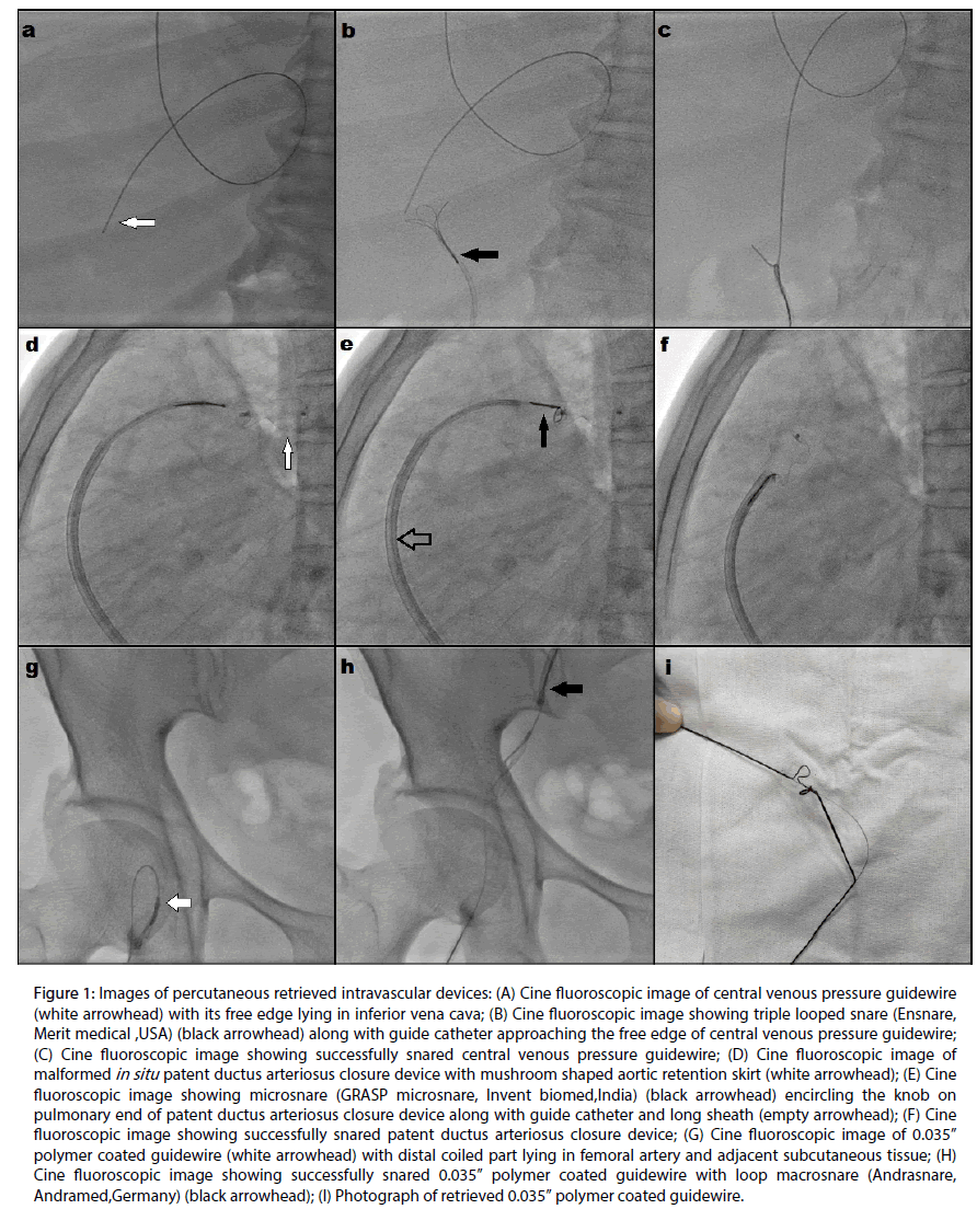 interventional-fluoroscopic-image